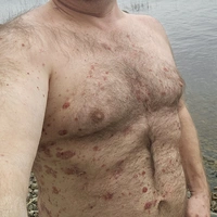 Nalukka80